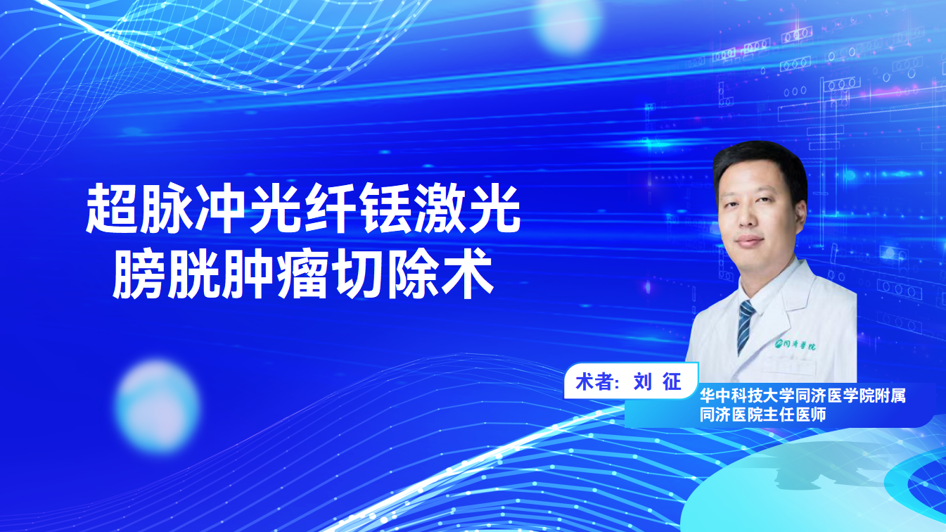 超脉冲光纤铥激光膀胱肿瘤切除术