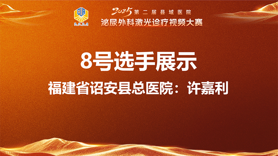 7.5Fr电子软镜联合头端可弯曲吸引鞘激光碎石体会（同时治疗输尿管肾结石）-许嘉利.mp4